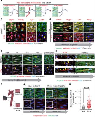 Endothelial cell elongation and alignment in response to shear stress requires acetylation of microtubules